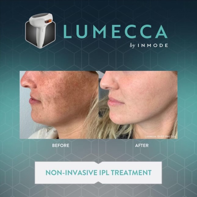 Rejuventu Aesthetics